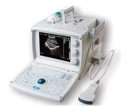 Ultrasound Scanner Portable Electronic Convexdigital Wed 9618