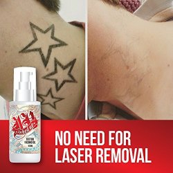 Up Inked Tattoo Fading Oil - No Need Laser