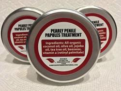 Pearly Penile Papules Removal Cream - Fordyce Spots Treatment For Pearly Penile Papules