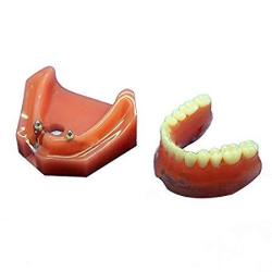 Doc.Royal Dental Study Teaching Model Teeth Implant Repair Model For Dentist